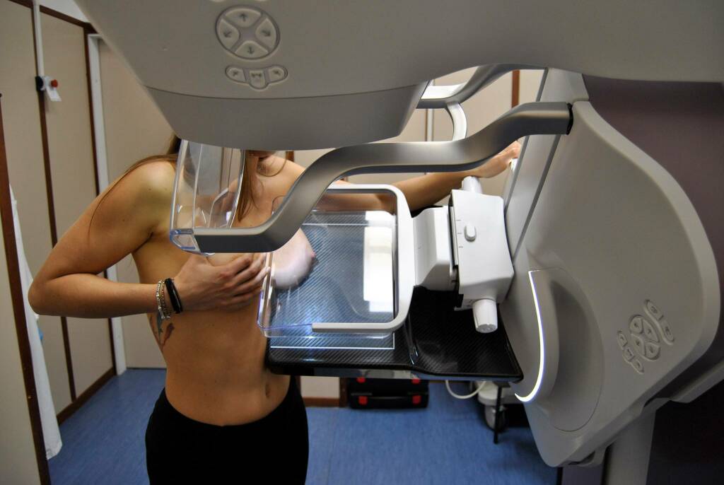 mammografia 